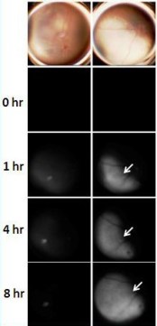 Caspase Bioimaging